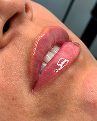 Hydra Gloss Lips